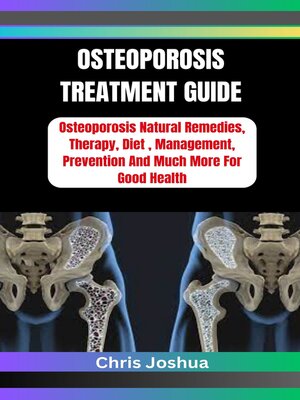 cover image of OSTEOPOROSIS  TREATMENT GUIDE